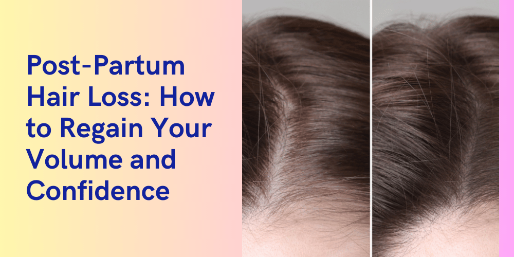 post partum hair vitamins