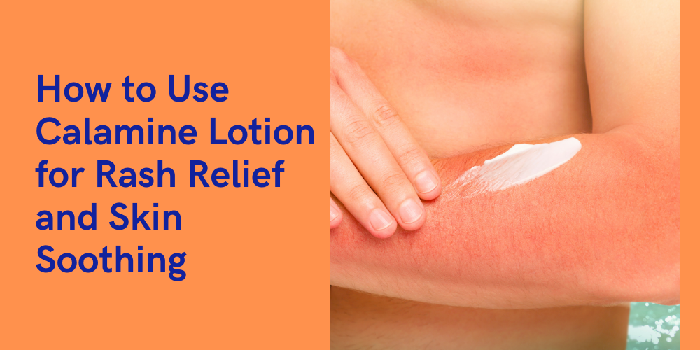 How to Use Calamine Lotion for Rash Relief and Skin Soothing